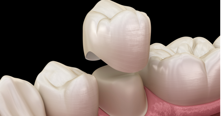 Heathmont Website Images 14 Dental Crown Page (1) Heathmont Website Images 14 Dental Crown Page (1)