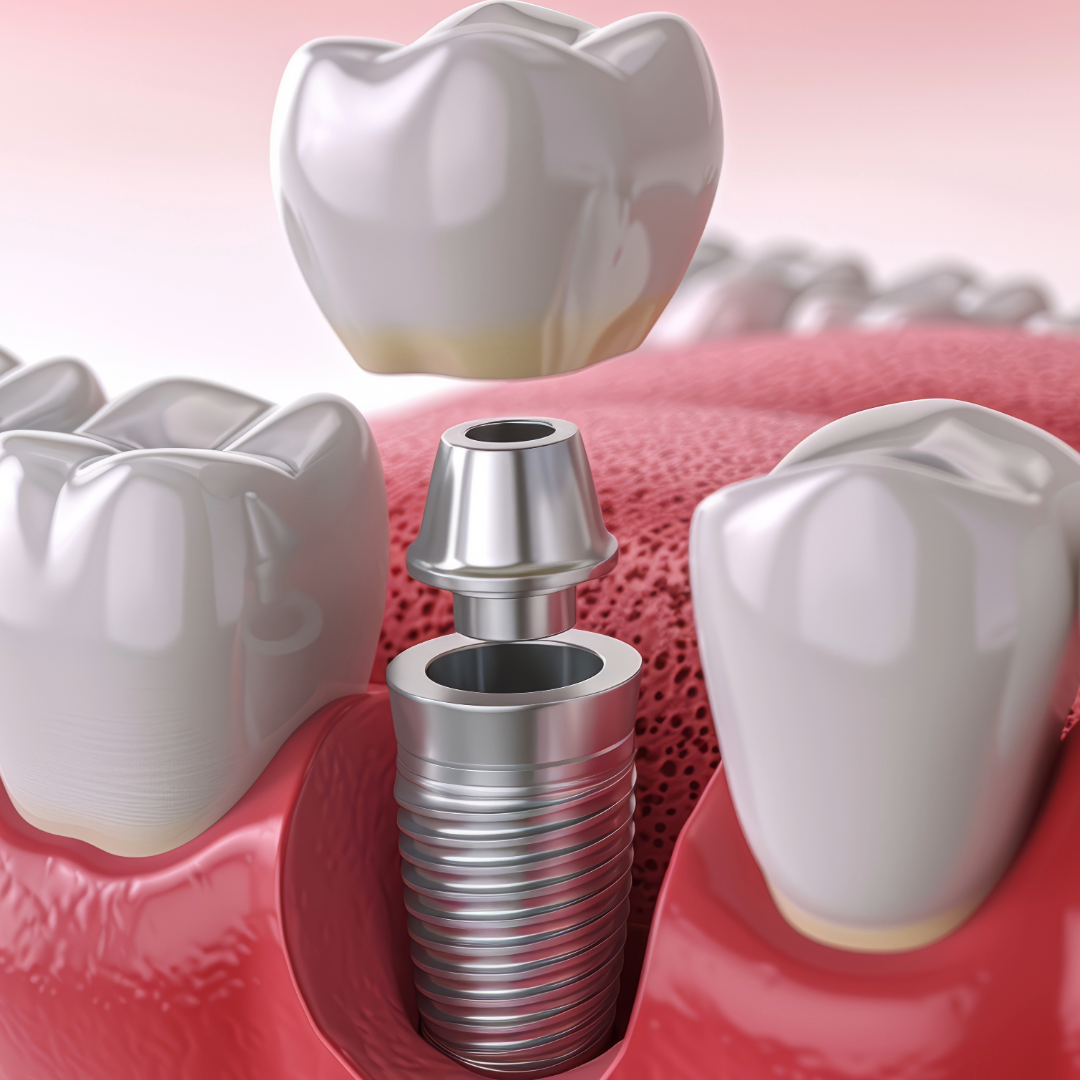 Website Images 12 Periodental Image Website Images 12 Periodental Image