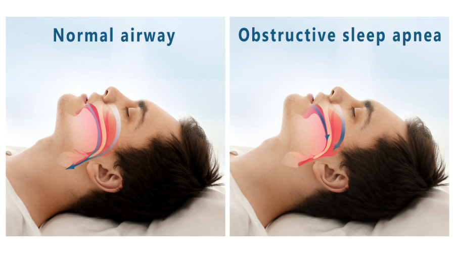 Website Images 15 Sleep Hygiene Image (3) Website Images 15 Sleep Hygiene Image (3)