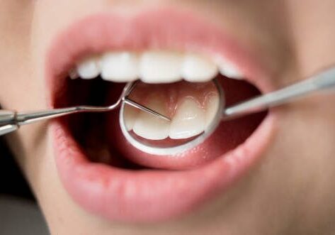 periodontal - gum treatment with Heathmont dentist