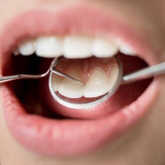 periodontal - gum treatment with Heathmont dentist