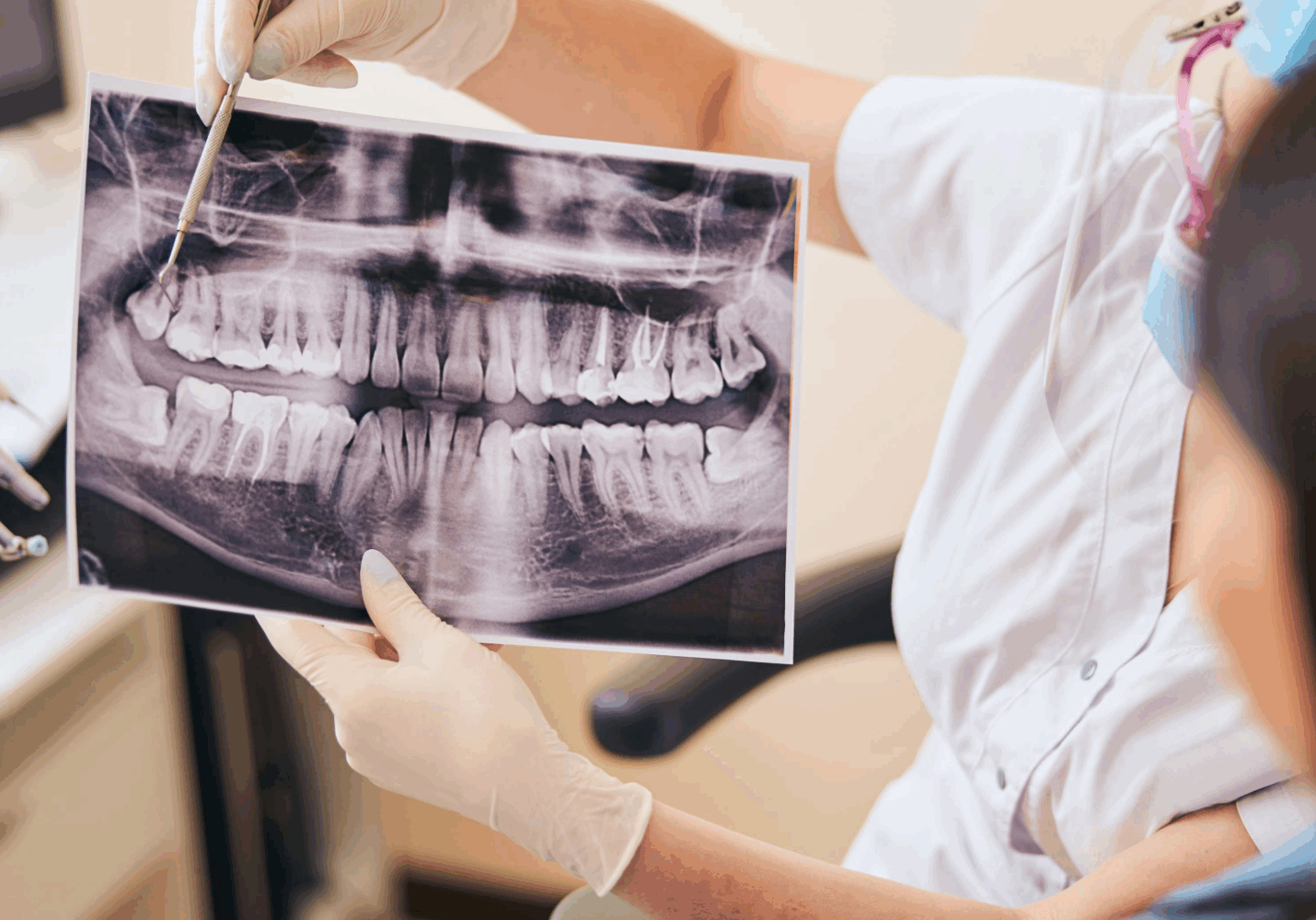 Heathmont Website Images 10 Wisdom Teeth Page (1)