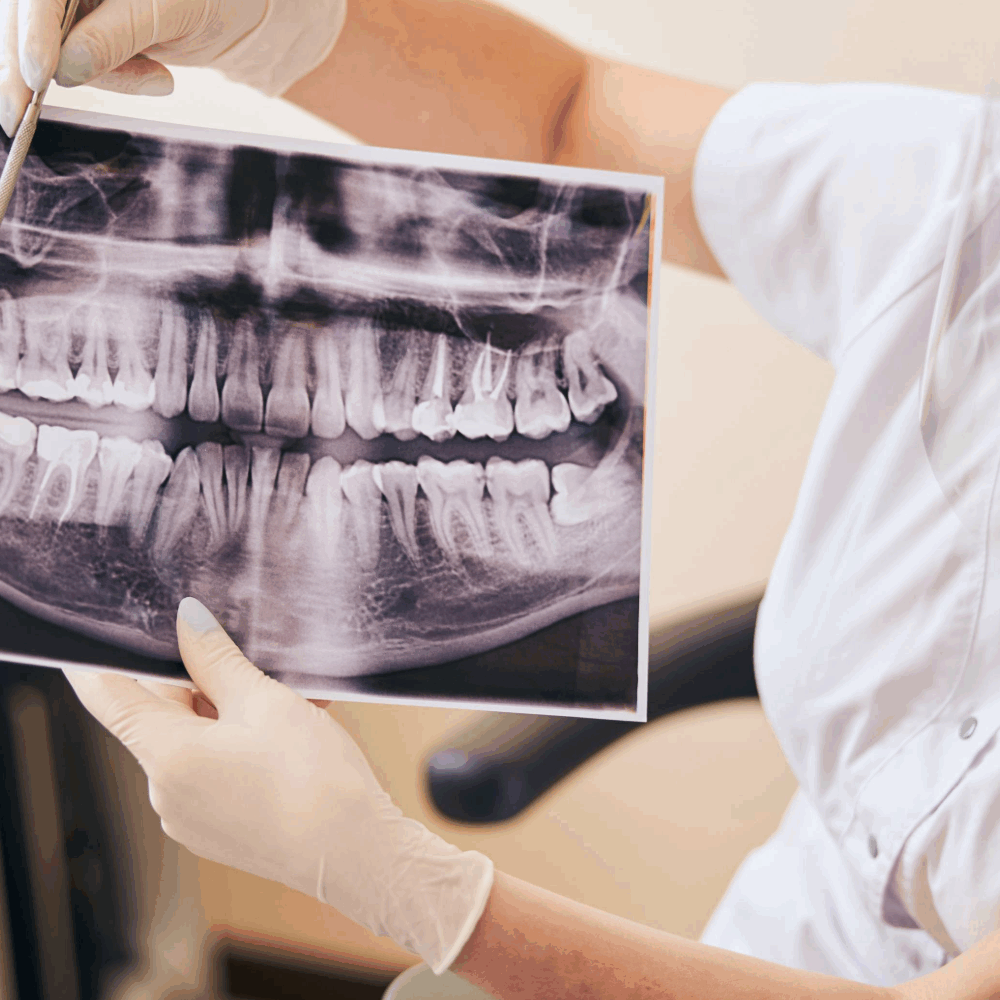 Heathmont Website Images 10 Wisdom Teeth Page (1)