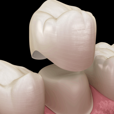 Heathmont Website Images 14 Dental Crown Page (1)