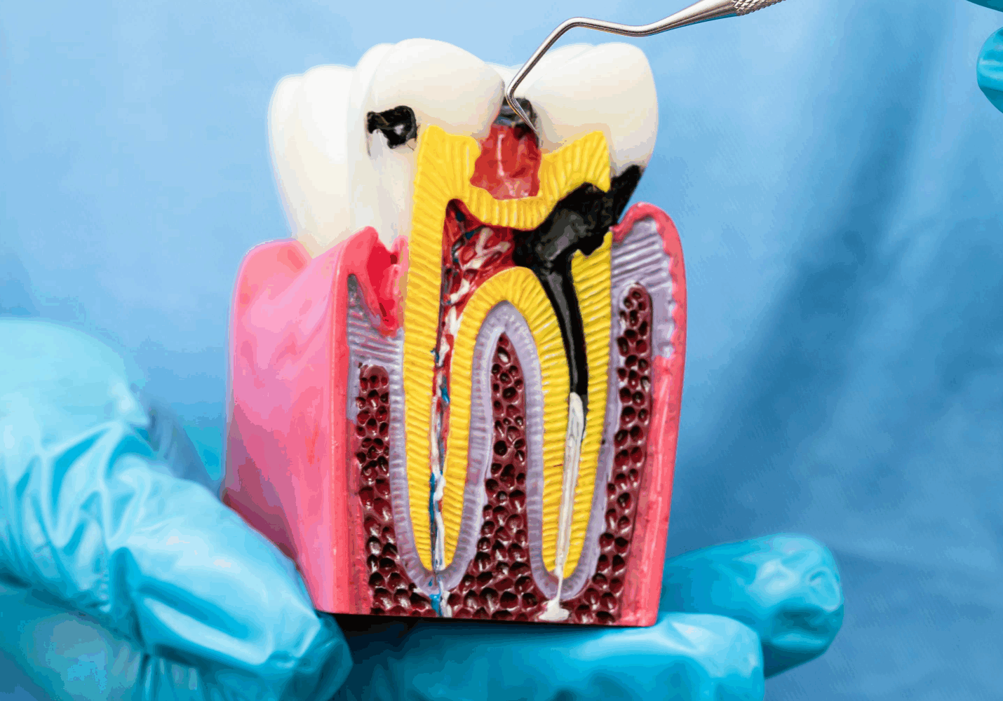 Heathmont Website Images 8 Endontics Page